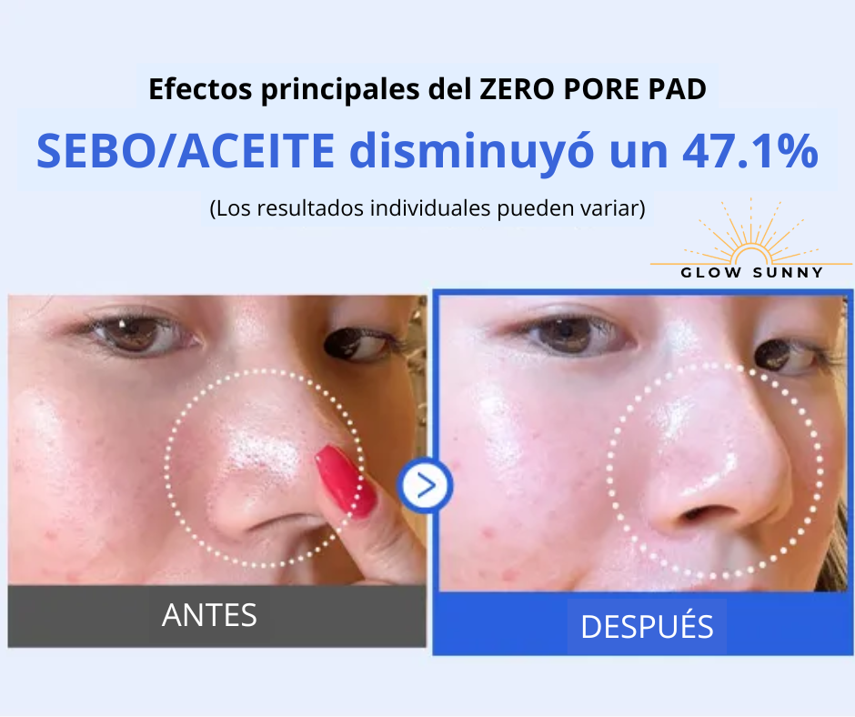 Medicube Zero Pore Pad - Almohadilla coreana (70pcs)